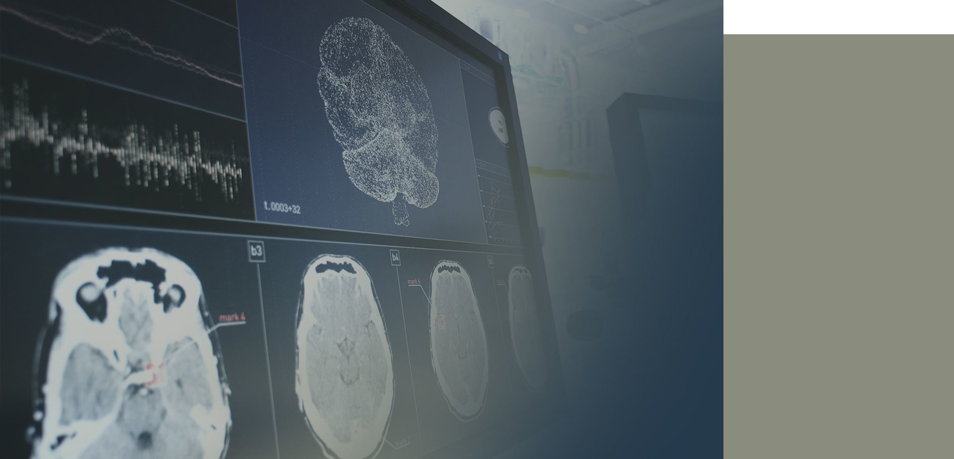 Traumatic Brain Injury